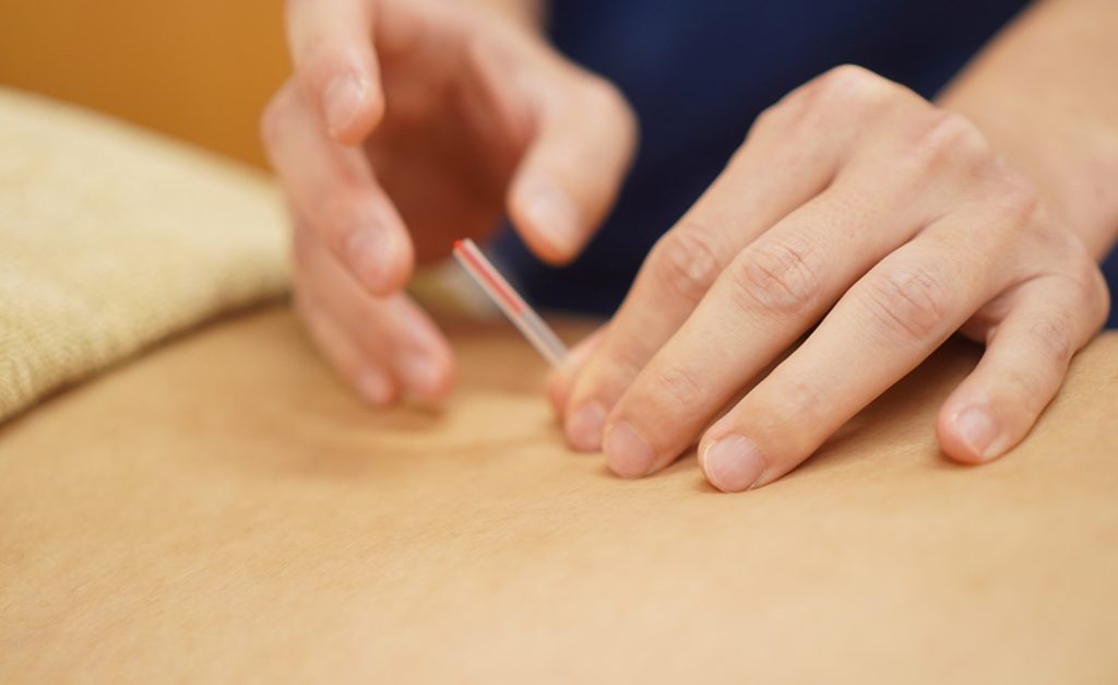 画像に alt 属性が指定されていません。ファイル名: acupuncture-1-1024x627.jpg